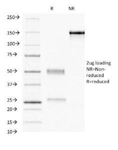 Anti-Progesterone Receptor antibody