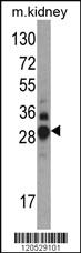 Anti-DDAH1 Rabbit Polyclonal Antibody