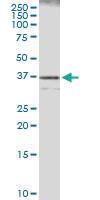 Anti-CASP7 Rabbit Polyclonal Antibody