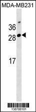 Anti-GG2L4 Rabbit Polyclonal Antibody (APC (Allophycocyanin))