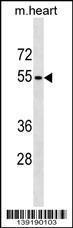 Anti-RHCG Rabbit Polyclonal Antibody (HRP (Horseradish Peroxidase))