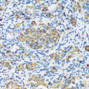 Immunohistochemistry analysis of paraffin-embedded rat ovary using Anti-APOBEC3F Antibody (A9054) at a dilution of 1:100 (40X lens). Perform microwave antigen retrieval with 10 mM PBS buffer pH 7.2 before commencing with IHC staining protocol