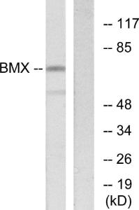 Western blot analysis of lysates from COS7 cells using Anti-BMX Antibody. The right hand lane represents a negative control, where the antibody is blocked by the immunising peptide