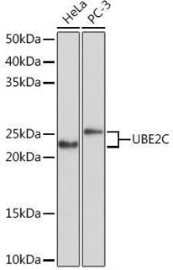 Western blot analysis of extracts of various cell lines, using Anti-UBE2C Antibody [ARC1166] (A305332) at 1:1,000 dilution The secondary antibody was Goat Anti-Rabbit IgG H&L Antibody (HRP) at 1:10,000 dilution Lysates/proteins were present at 25 µg per lane