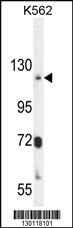 Anti-ATP8A2 Rabbit Polyclonal Antibody