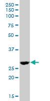 Anti-DHRS4 Mouse Polyclonal Antibody