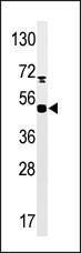 Anti-MAPKAPK5 Rabbit Polyclonal Antibody (AP (Alkaline Phosphatase))