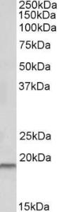 Anti-SPINT2 antibody