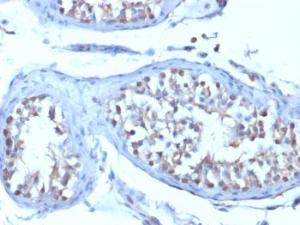 Immunohistochemical analysis of formalin-fixed, paraffin-embedded human testicular carcinoma using Anti-B7H4 Antibody [B7H4/1788]