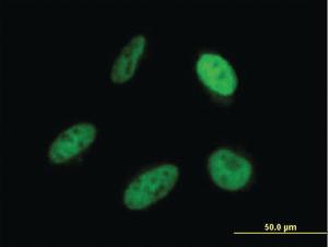 Anti-SRP68 Mouse Monoclonal Antibody [clone: 3A3]