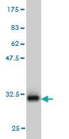 Anti-PANK2 Mouse Monoclonal Antibody [clone: 2B12]