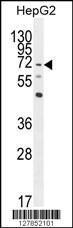 Anti-NRROS Rabbit Polyclonal Antibody (Biotin)