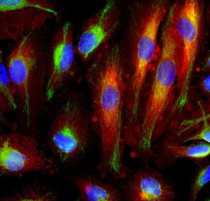 Antibody anti-annexin VI 4G3 100 µl