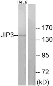 Western blot analysis of lysates from HeLa cells using Anti-JIP3 Antibody The right hand lane represents a negative control, where the antibody is blocked by the immunising peptide