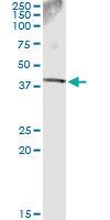 Anti-SDSL Mouse Monoclonal Antibody [clone: 2F8-6C9]