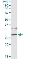 Anti-CD79B Antibody Pair