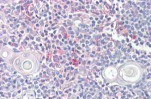 Anti-LITAF Antibody (A83498) (6.5 µg/ml) staining of paraffin embedded Human Thymus. Steamed antigen retrieval with citrate buffer pH 6, AP-staining