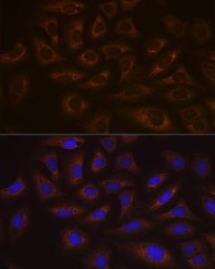 Immunofluorescence analysis of U-2 OS cells using Anti-UBE2C Antibody [ARC1166] (A305332) at a dilution of 1:100 (40x lens) DAPI was used to stain the cell nuclei (blue)