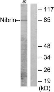 Western blot analysis of lysates from Jurkat cells using Anti-Nibrin Antibody. The right hand lane represents a negative control, where the antibody is blocked by the immunising peptide