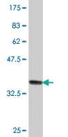 Anti-AMY2B Mouse Polyclonal Antibody