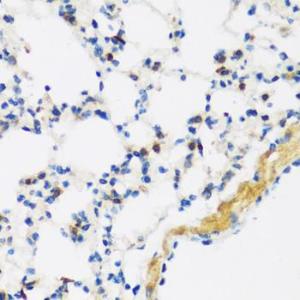 Immunohistochemistry analysis of paraffin-embedded mouse lung using Anti-APOBEC3F Antibody (A9054) at a dilution of 1:100 (40X lens). Perform microwave antigen retrieval with 10 mM PBS buffer pH 7.2 before commencing with IHC staining protocol