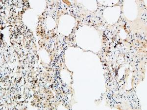 Immunohistochemical analysis of paraffin-embedded human lung using Anti-VEGF-D Antibody