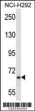 Anti-MYB Rabbit Polyclonal Antibody (FITC (Fluorescein Isothiocyanate))