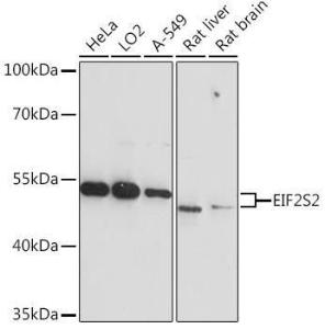 Western blot analysis of extracts of various cell lines, using Anti-EIF2S2/EIF2B Antibody (A93215) at 1:3,000 dilution. The secondary Antibody was Goat Anti-Rabbit IgG H&L Antibody (HRP) at 1:10000 dilution. Lysates/proteins were present at 25 µg per lane