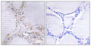 Immunohistochemical analysis of paraffin-embedded human thyroid gland tissue using Anti-BMX Antibody. The right hand panel represents a negative control, where the antibody was pre-incubated with the immunising peptide