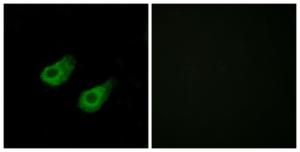 Immunofluorescence analysis of HeLa cells using Anti-JIP3 Antibody The right hand panel represents a negative control, where the antibody was pre-incubated with the immunising peptide