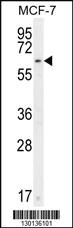 Anti-CTDSPL2 Rabbit Polyclonal Antibody