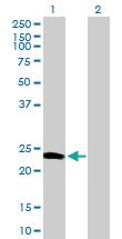 Anti-CALN1 Mouse Polyclonal Antibody