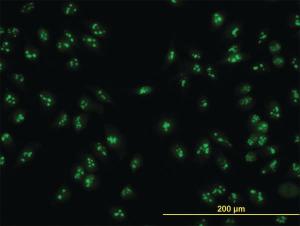 Anti-NOP16 Mouse Monoclonal Antibody [clone: 1G4]