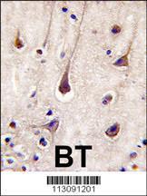 Anti-PIK3R2 Rabbit Polyclonal Antibody (FITC (Fluorescein Isothiocyanate))