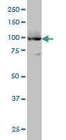 Anti-ATP2A3 Mouse monoclonal antibody [clone: 2H3]