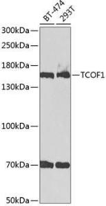 Anti-TCOF1 Antibody (A9055)