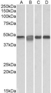 Anti-MAP2K2 Antibody (A85164) (0.3µg/ml) staining of Daudi (A), Jurkat (B), K562 (C) and Molt4 (D) lysates (35µg protein in RIPA buffer). Primary incubation was 1 hour. Detected by chemiluminescence.