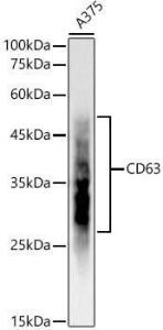 Western blot analysis of A375, using Anti-CD63 Antibody [ARC51703] (A305333) at 1:1,000 dilution. The secondary antibody was Goat Anti-Rabbit IgG H&L Antibody (HRP) at 1:10,000 dilution.