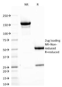 SDS-PAGE analysis of Anti-B7H4 Antibody [B7H4/1788] under non-reduced and reduced conditions; showing intact IgG and intact heavy and light chains, respectively. SDS-PAGE analysis confirms the integrity and purity of the Antibody