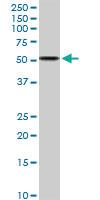 Anti-ALDH3A2 Rabbit Polyclonal Antibody