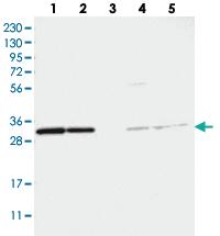 Anti-TATDN1 Rabbit Polyclonal Antibody