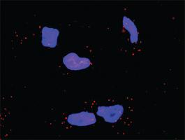 Anti-RICTOR + AKT1 Antibody Pair