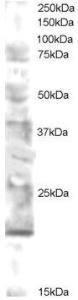 Anti-UBE2V2 Antibody (A83500) staining (0.5µg/ml) of human brain lysate (RIPA buffer, 30µg total protein per lane). Primary incubated for 12 hour. Detected by western blot using chemiluminescence.