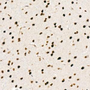 Immunohistochemistry analysis of paraffin-embedded mouse brain using Anti-Chk2 (phospho Thr68) Antibody [ARC58395] (A309132) at a dilution of 1:1,000 (40x lens). Perform high pressure antigen retrieval with 10 mM citrate buffer pH 6.0 before commencing with IHC staining protocol.