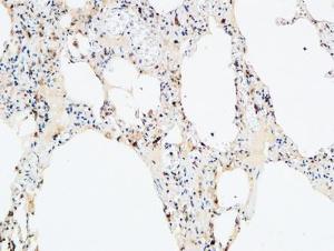 Immunohistochemical analysis of paraffin-embedded human lung using Anti-VEGF-D Antibody