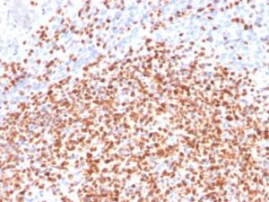 Immunohistochemical analysis of formalin-fixed, paraffin-embedded human lymph node using Anti-OCT-2 Antibody [Oct2/2137]