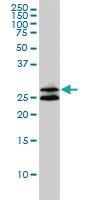 Anti-ASB9 Mouse Monoclonal Antibody [clone: 1D8]