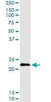 Anti-CGB Polyclonal Antibody Pair