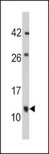 Anti-FKBP1B Rabbit polyclonal antibody