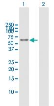 Anti-ALDH3A2 Rabbit Polyclonal Antibody